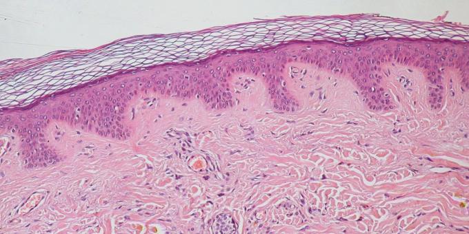 Fatti del corpo umano: la pelle è l'organo più pesante