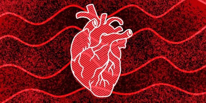 11 segni che si possono accadere arresto cardiaco