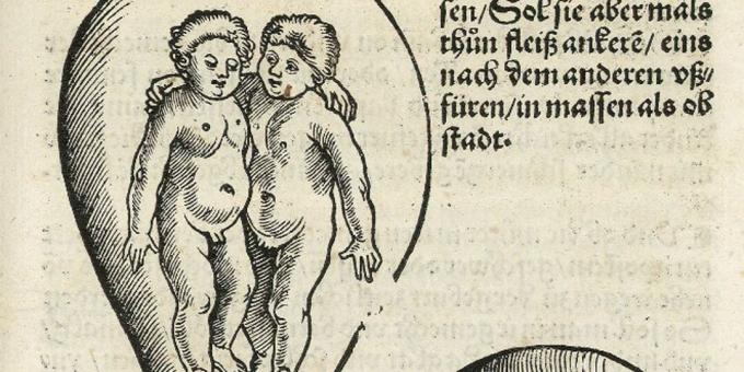 Bambini del Medioevo: Gemelli nel grembo materno, Eucharius Rodion