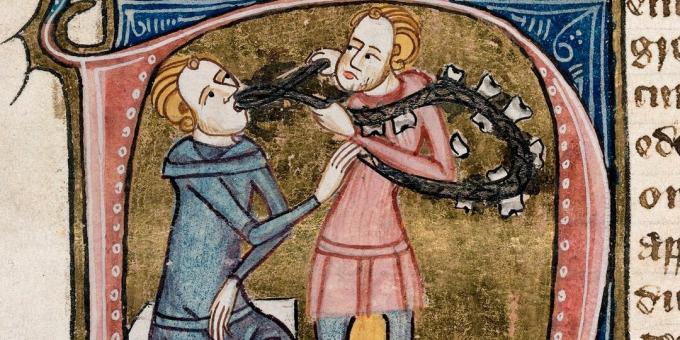 Medicina medievale: estrazione del dente. Omne Bonum, Londra, 1360-1375