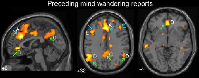 Le frecce verdi indicano le aree del cervello responsabile di "comportamento automatico". Blue Arrow - la parte "esecutivo" del cervello. A - cingolato dorsale, B - ventralanya cingolata, C - precuneus emisferi cerebrali, D - giunzione tempoparietale bilaterale, E - dorsolateral corteccia prefrontale