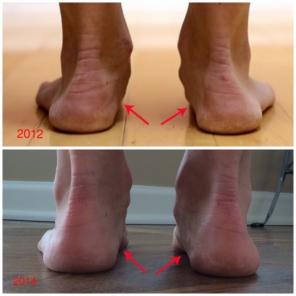 Come per l'esecuzione in scarpe minimaliste piedi cambiano