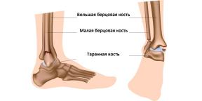 Come riconoscere una frattura alla caviglia e cosa fare dopo