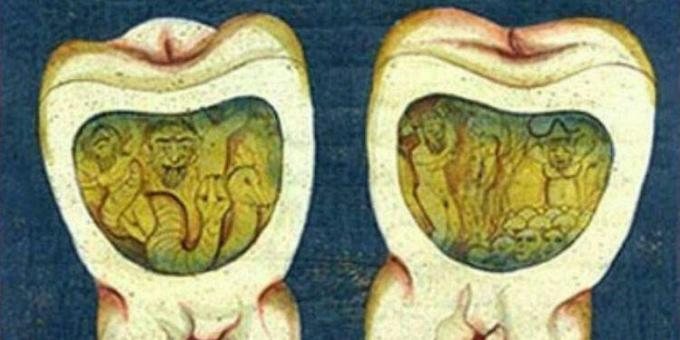 Medicina medievale: una pagina dal trattato dentale ottomano, XVII secolo.